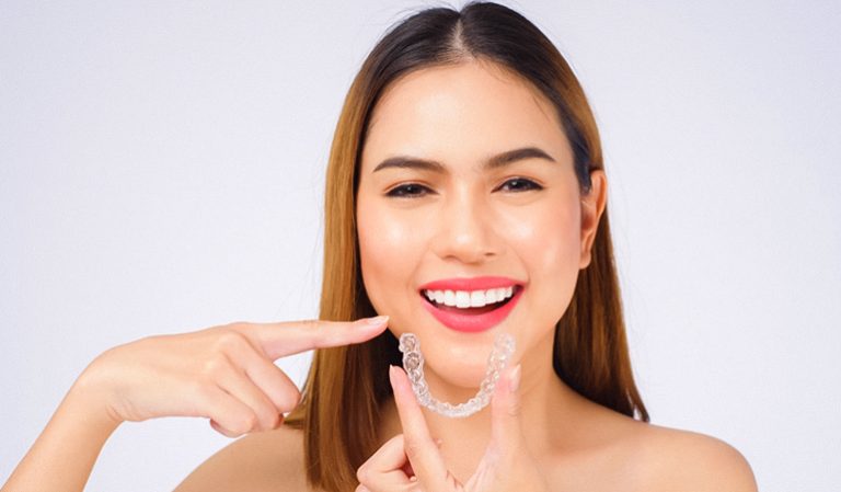 Invisalign Braces